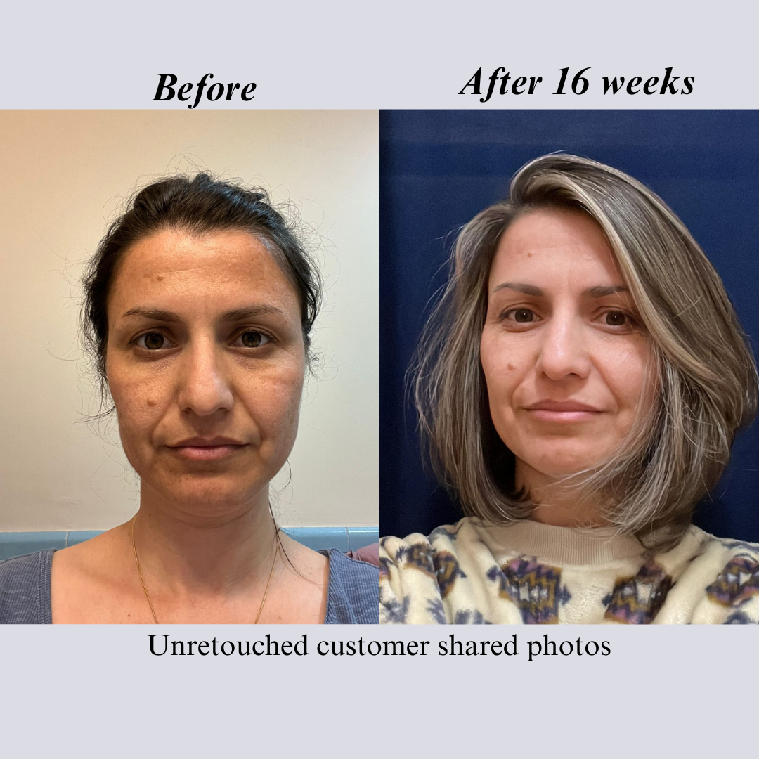 Before and after face photos of a customer, labeled after 16 weeks