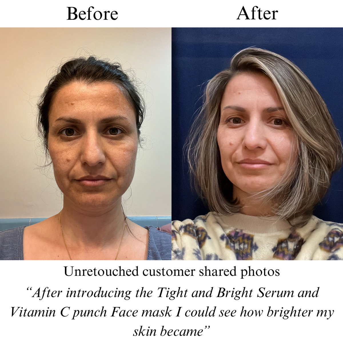 Before and after photos of a woman's face with a customer quote