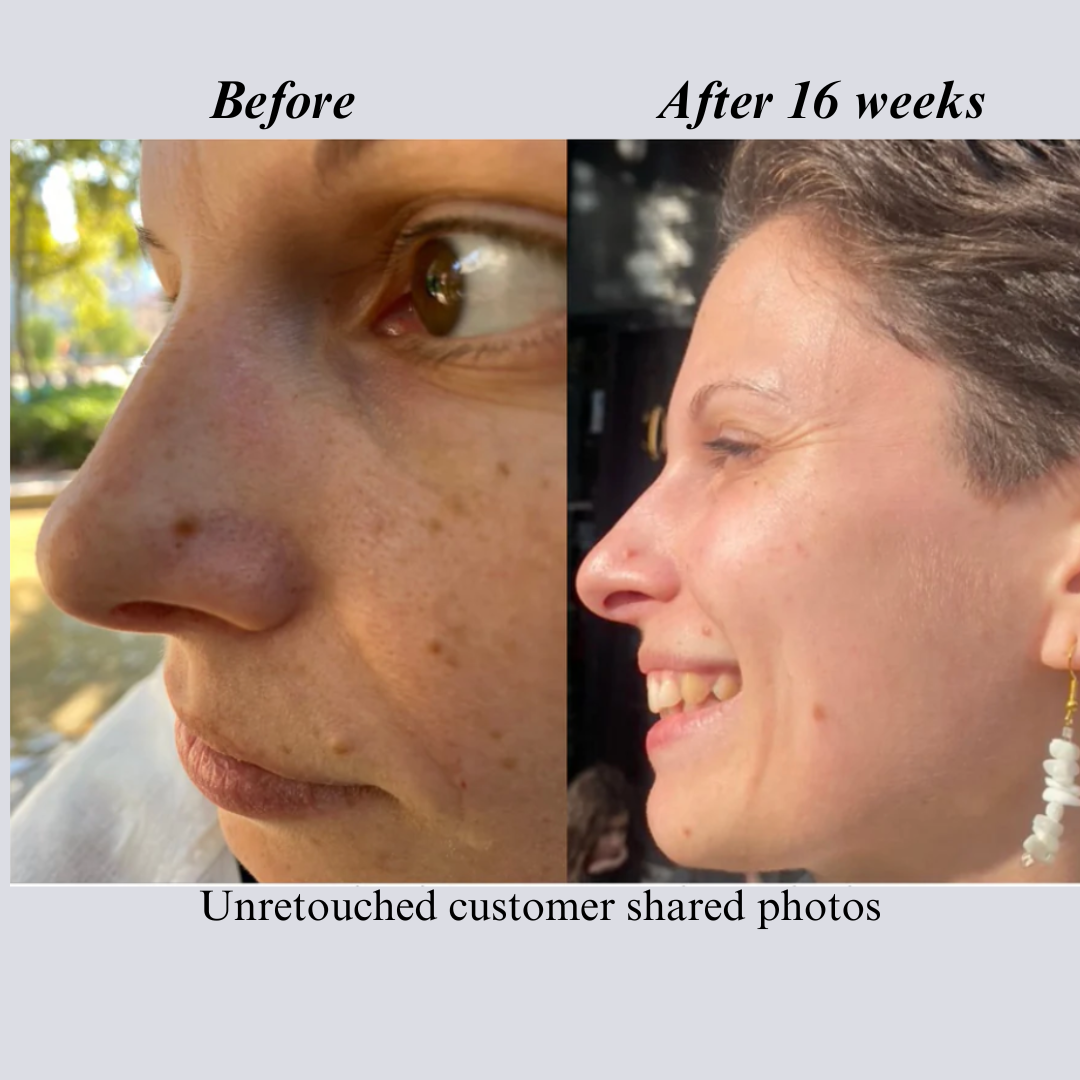 Before and after side-profile photos of a customer, labeled after 16 weeks
