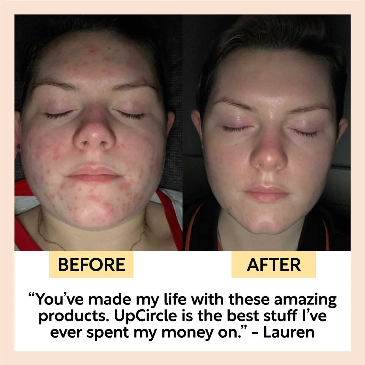 Before and after photos of a customer's face with a quoted testimonial