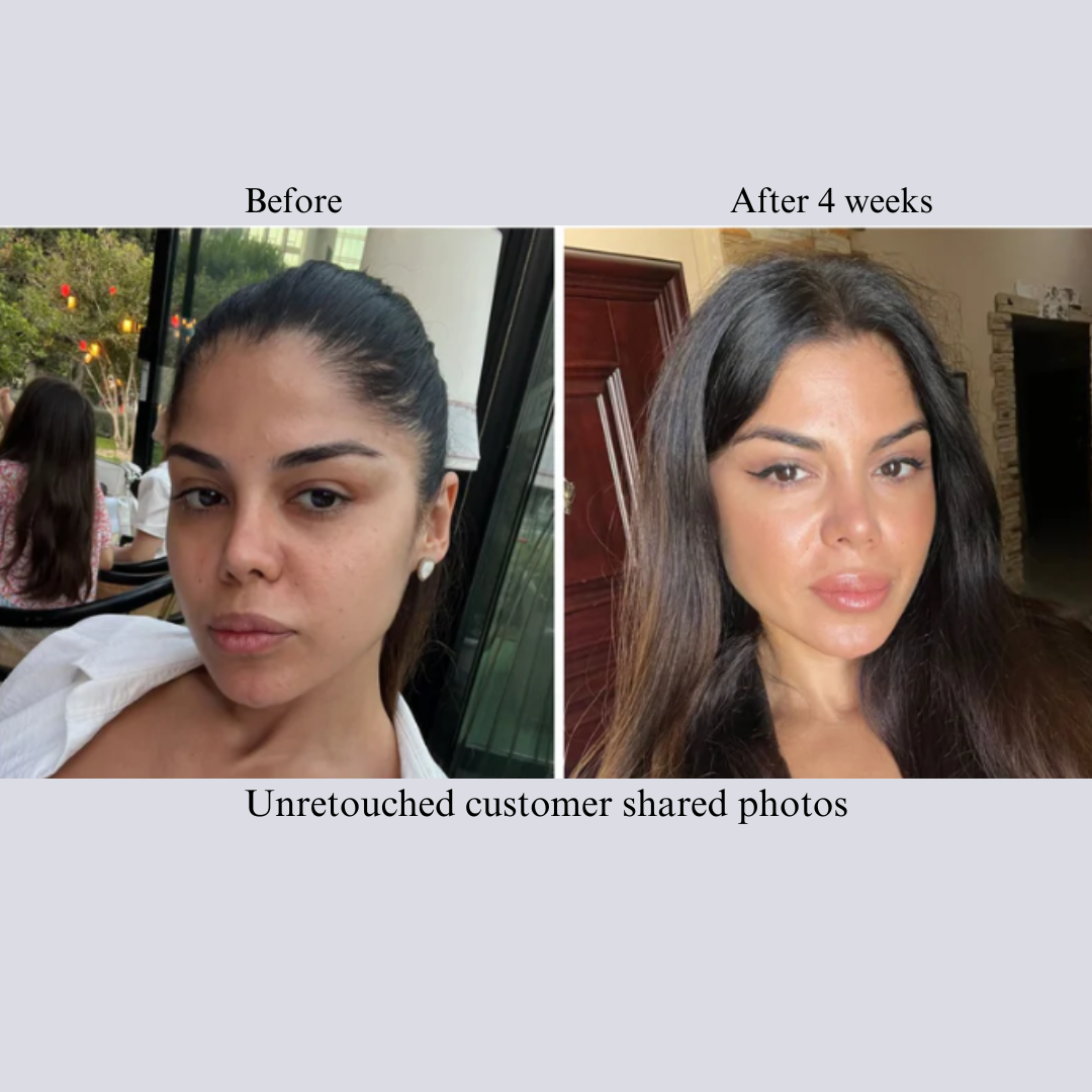 Before and after face photos of a customer, labeled after 4 weeks