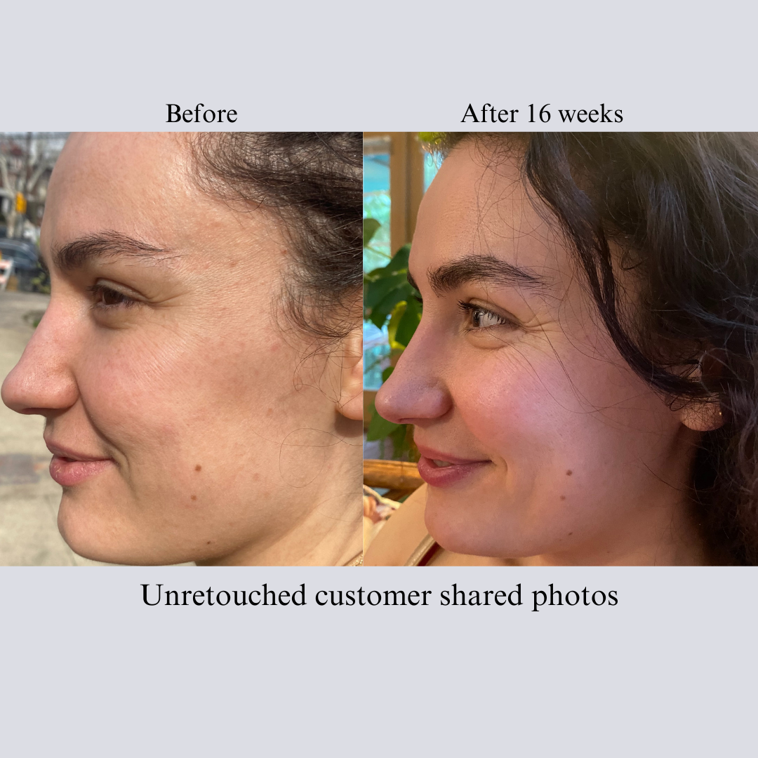 Before and after side-profile photos of a customer, labeled after 16 weeks