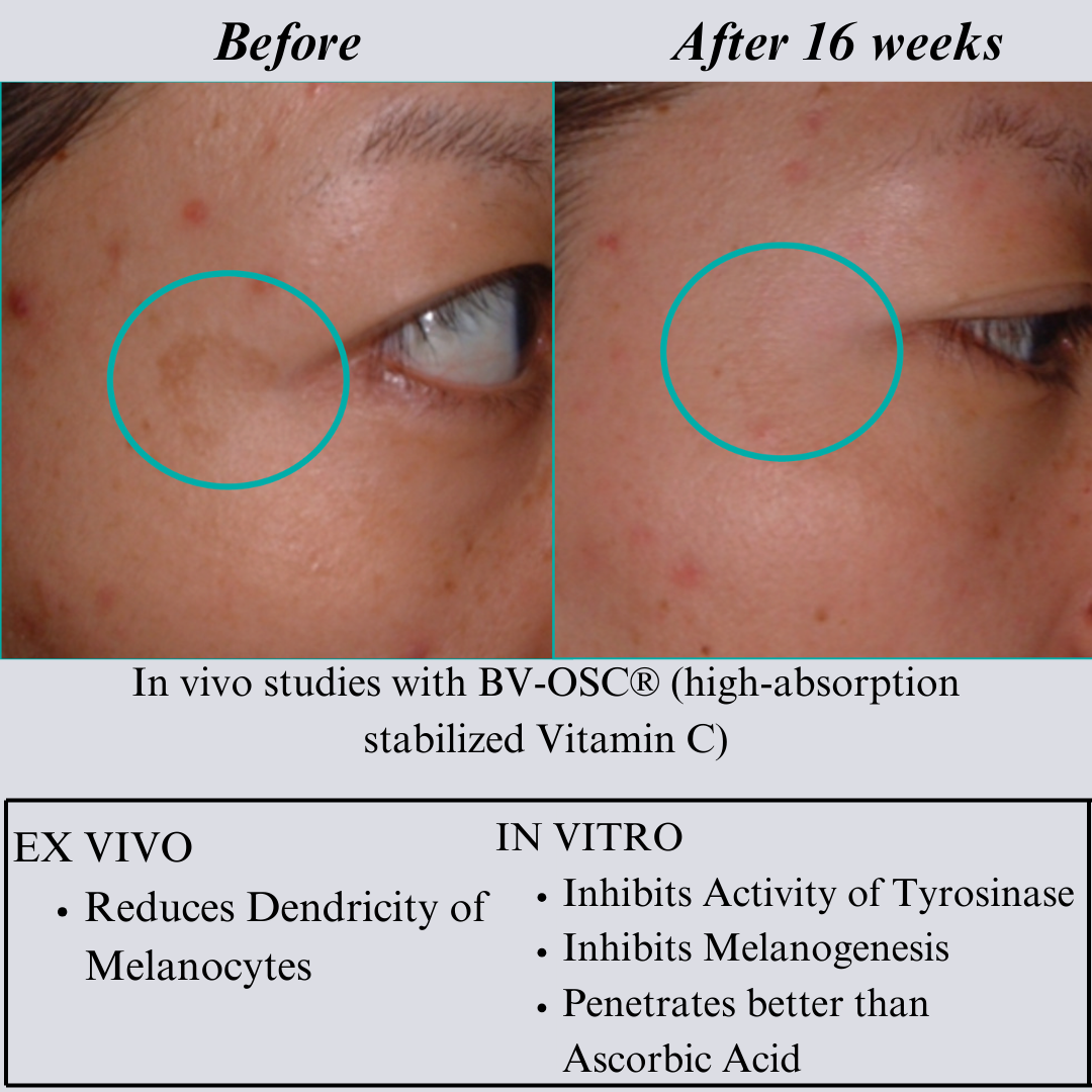Close-up skin photos with circled areas beside a text panel on in vivo, ex vivo and in vitro studies